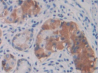 Immunohistochemistry (Formalin/PFA-fixed paraffin-embedded sections) - Anti-Warp antibody (AB231030), expandable thumbnail