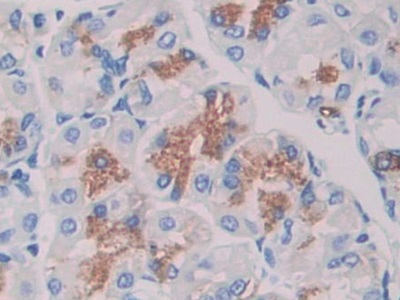 Immunohistochemistry (Formalin/PFA-fixed paraffin-embedded sections) - Anti-Warp antibody (AB231030), expandable thumbnail