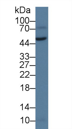 Western blot - Anti-Warp antibody (AB231030), expandable thumbnail