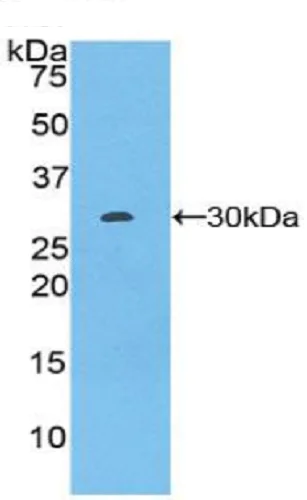 Western blot - Anti-Warp antibody (AB231030)