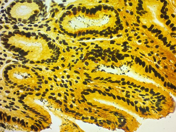 Immunohistochemistry (Formalin/PFA-fixed paraffin-embedded sections) - Warthin-Starry Stain Kit (Microorganism Stain) (AB150688), expandable thumbnail