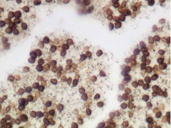 Immunohistochemistry (Formalin/PFA-fixed paraffin-embedded sections) - Warthin-Starry Stain Kit (Microorganism Stain) (AB150688), expandable thumbnail