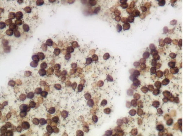 Immunohistochemistry (Formalin/PFA-fixed paraffin-embedded sections) - Warthin-Starry Stain Kit (Microorganism Stain) (AB150688)