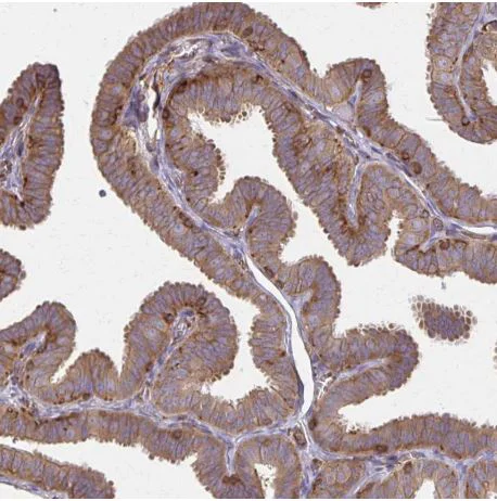 Immunohistochemistry (Formalin/PFA-fixed paraffin-embedded sections) - Anti-WASF2/WAVE2 antibody (AB204376)
