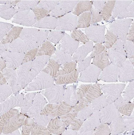 Immunohistochemistry (Formalin/PFA-fixed paraffin-embedded sections) - Anti-WASF2/WAVE2 antibody (AB204376)