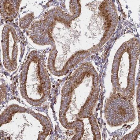 Immunohistochemistry (Formalin/PFA-fixed paraffin-embedded sections) - Anti-WASF2/WAVE2 antibody (AB204376)