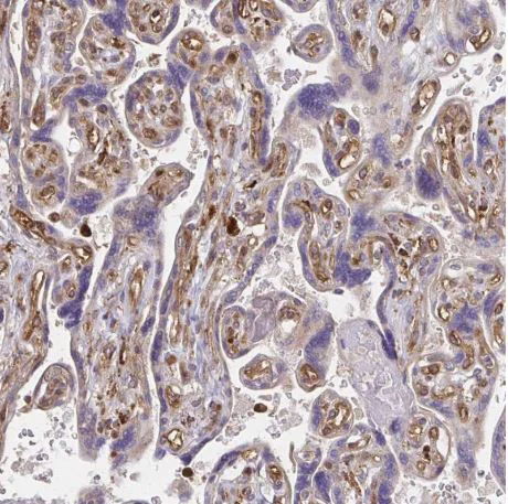 Immunohistochemistry (Formalin/PFA-fixed paraffin-embedded sections) - Anti-WASF2/WAVE2 antibody (AB204376)