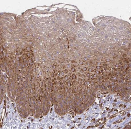 Immunohistochemistry (Formalin/PFA-fixed paraffin-embedded sections) - Anti-WASF2/WAVE2 antibody (AB204376)