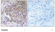 Immunohistochemistry (Formalin/PFA-fixed paraffin-embedded sections) - Anti-WASF3 antibody (AB110739), expandable thumbnail