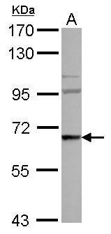 Western blot - Anti-WASF3 antibody (AB272893)