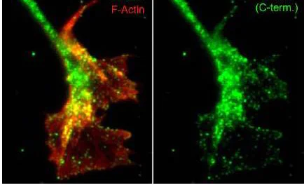 Immunocytochemistry/ Immunofluorescence - Anti-WASH1 antibody - C-terminal (AB157592)