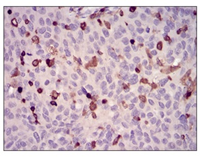 Immunohistochemistry (Formalin/PFA-fixed paraffin-embedded sections) - Anti-WASP/Wiskott-Aldrich syndrome protein antibody [7B10E4] (AB202025)