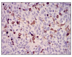 Immunohistochemistry (Formalin/PFA-fixed paraffin-embedded sections) - Anti-WASP/Wiskott-Aldrich syndrome protein antibody [7B10E4] (AB202025)