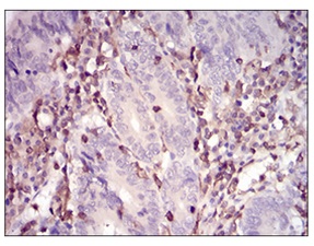 Immunohistochemistry (Formalin/PFA-fixed paraffin-embedded sections) - Anti-WASP/Wiskott-Aldrich syndrome protein antibody [7B10E4] (AB202025)