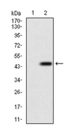 Western blot - Anti-WASP/Wiskott-Aldrich syndrome protein antibody [7B10E4] (AB202025)