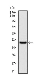 Western blot - Anti-WASP/Wiskott-Aldrich syndrome protein antibody [7B10E4] (AB202025)