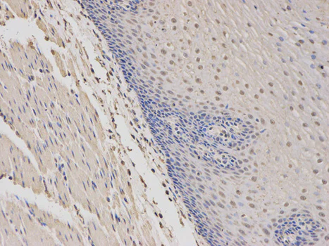 Immunohistochemistry (Formalin/PFA-fixed paraffin-embedded sections) - Anti-WASP/Wiskott-Aldrich syndrome protein antibody (AB180816)