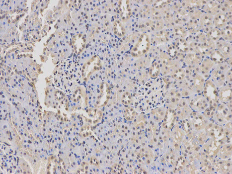 Immunohistochemistry (Formalin/PFA-fixed paraffin-embedded sections) - Anti-WASP/Wiskott-Aldrich syndrome protein antibody (AB180816)