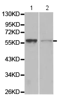 Western blot - Anti-WASP/Wiskott-Aldrich syndrome protein antibody (AB180816)