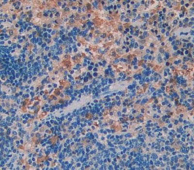 Immunohistochemistry (Formalin/PFA-fixed paraffin-embedded sections) - Anti-WASP/Wiskott-Aldrich syndrome protein antibody (AB233216), expandable thumbnail