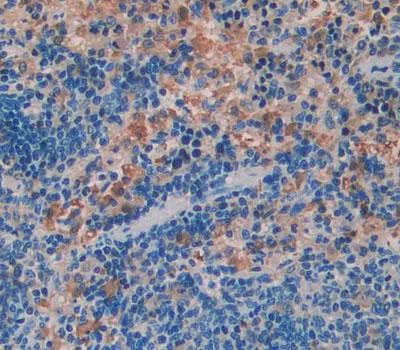 Immunohistochemistry (Formalin/PFA-fixed paraffin-embedded sections) - Anti-WASP/Wiskott-Aldrich syndrome protein antibody (AB233216)