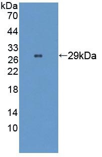 Western blot - Anti-WASP/Wiskott-Aldrich syndrome protein antibody (AB233216), expandable thumbnail