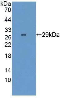 Western blot - Anti-WASP/Wiskott-Aldrich syndrome protein antibody (AB233216)