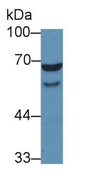 Western blot - Anti-WASP/Wiskott-Aldrich syndrome protein antibody (AB233216)