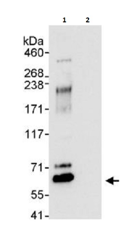 Immunoprecipitation - Anti-WASP/Wiskott-Aldrich syndrome protein antibody (AB264134)