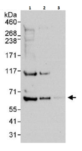 Western blot - Anti-WASP/Wiskott-Aldrich syndrome protein antibody (AB264134)