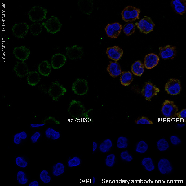 Immunocytochemistry/ Immunofluorescence - Anti-WASP/Wiskott-Aldrich syndrome protein antibody [EP2541Y] (AB75830), expandable thumbnail