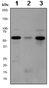 Western blot - Anti-WASP/Wiskott-Aldrich syndrome protein antibody [EPR2540Y] (AB68182)