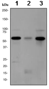 Western blot - Anti-WASP/Wiskott-Aldrich syndrome protein antibody [EPR2540Y] - BSA and Azide free (AB243131)