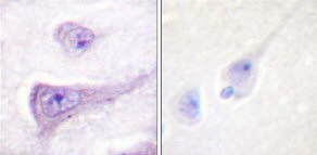 Immunohistochemistry (Formalin/PFA-fixed paraffin-embedded sections) - Anti-WASP/Wiskott-Aldrich syndrome protein (phospho Y290) antibody (AB59278)