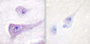 Immunohistochemistry (Formalin/PFA-fixed paraffin-embedded sections) - Anti-WASP/Wiskott-Aldrich syndrome protein (phospho Y290) antibody (AB59278)