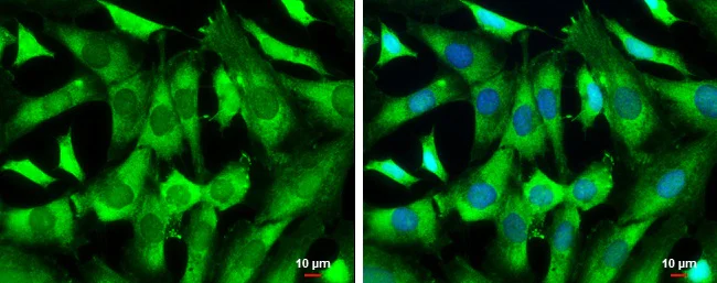 Immunocytochemistry/ Immunofluorescence - Anti-WAVE 1 antibody (AB272916)