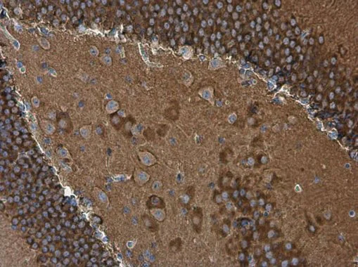 Immunohistochemistry (Formalin/PFA-fixed paraffin-embedded sections) - Anti-WAVE 1 antibody (AB272916)