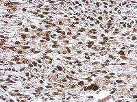 Immunohistochemistry (Formalin/PFA-fixed paraffin-embedded sections) - Anti-WBP11 antibody (AB154590), expandable thumbnail