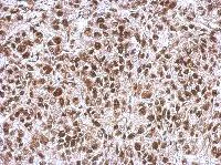 Immunohistochemistry (Formalin/PFA-fixed paraffin-embedded sections) - Anti-WBP11 antibody (AB154590)