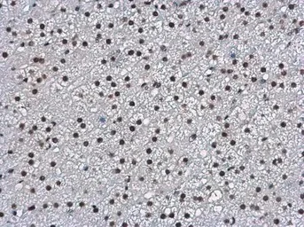 Immunohistochemistry (Formalin/PFA-fixed paraffin-embedded sections) - Anti-WBP11 antibody (AB154590)