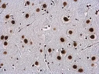 Immunohistochemistry (Formalin/PFA-fixed paraffin-embedded sections) - Anti-WBP11 antibody (AB154590)