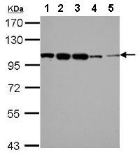 Western blot - Anti-WBP11 antibody (AB154590), expandable thumbnail
