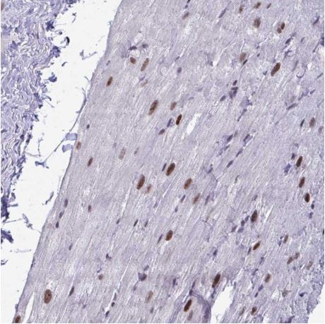 Immunohistochemistry (Formalin/PFA-fixed paraffin-embedded sections) - Anti-WBP11 antibody (AB204361)