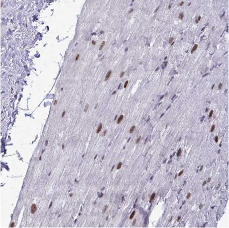 Immunohistochemistry (Formalin/PFA-fixed paraffin-embedded sections) - Anti-WBP11 antibody (AB204361)