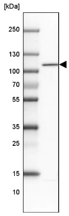 Western blot - Anti-WBP11 antibody (AB204361)