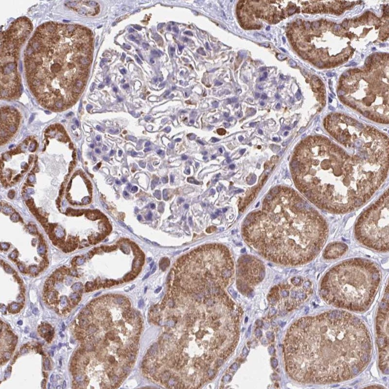 Immunohistochemistry (Formalin/PFA-fixed paraffin-embedded sections) - Anti-WBSCR16 antibody (AB247142), expandable thumbnail