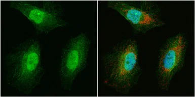 Immunocytochemistry/ Immunofluorescence - Anti-WBSCR22 antibody (AB97911)