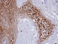 Immunohistochemistry (Formalin/PFA-fixed paraffin-embedded sections) - Anti-WBSCR22 antibody (AB97911)