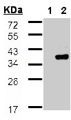 Western blot - Anti-WBSCR22 antibody (AB97911), expandable thumbnail