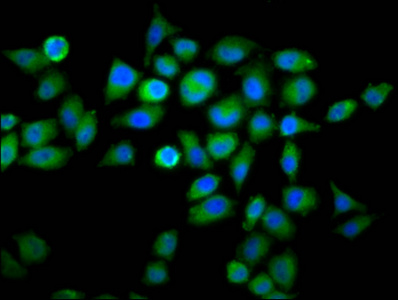 Immunocytochemistry/ Immunofluorescence - Anti-WDFY2 antibody (AB237623)